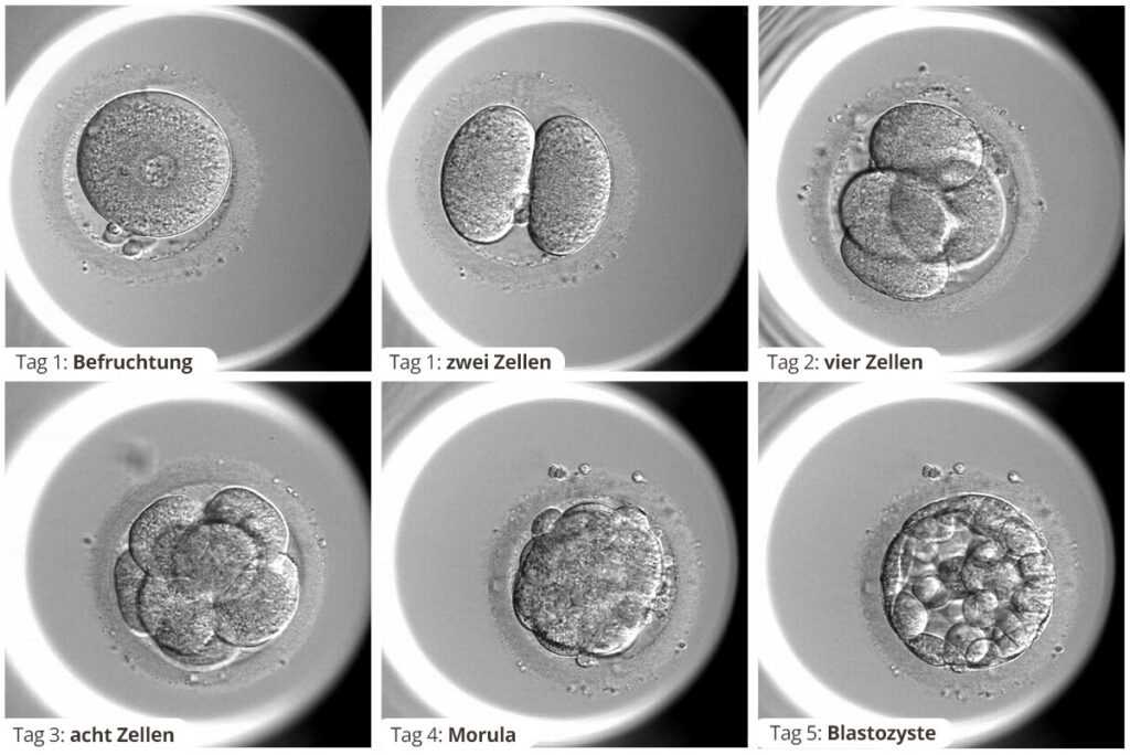 Embryonalentwicklung nach einer IVF (künstliche Befruchtung): Was passiert in den ersten sechs Tagen? 1 vyvoj embrya GYNCARE AU